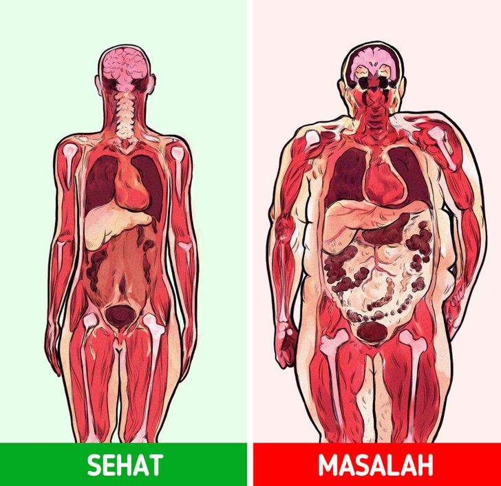 Bahaya Lemak Perut Terhadap Risiko Serangan Jantung Memahami Ancaman Tersembunyi Di Balik Lingkar Pinggang
